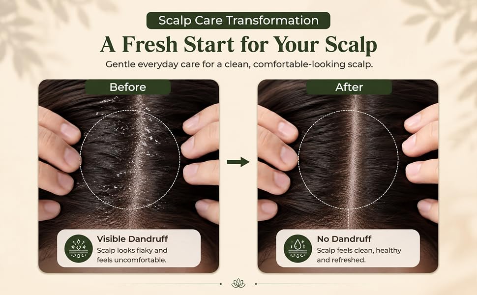 Ishmi Root Lock Shampoo | Hair Fall Control & Root Strengthening