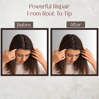 Ishmi Root Lock Shampoo | Hair Fall Control & Root Strengthening