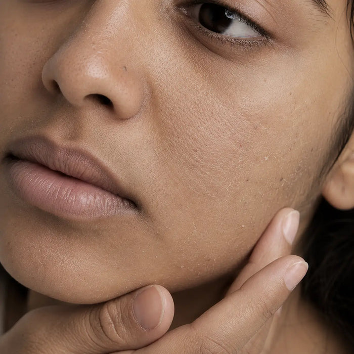 Dull, Dry Skin