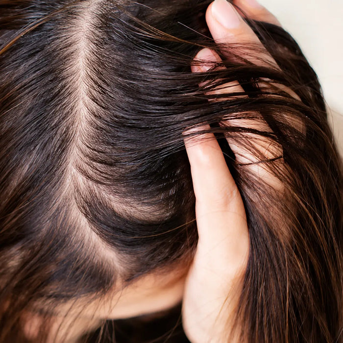 Hair Thinning/Loss